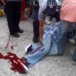 Robo con Violencia en Holguin deja un herido Robo con violencia en Holguin deja un herido